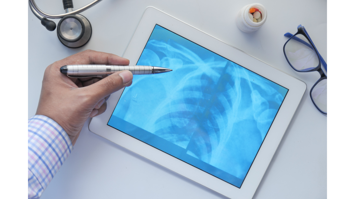 Xray on iPad